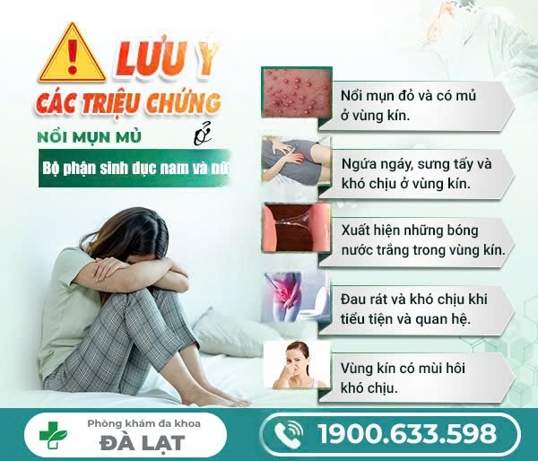 Hình ảnh minh họa